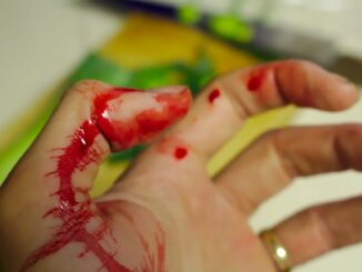 Verletzte Hand